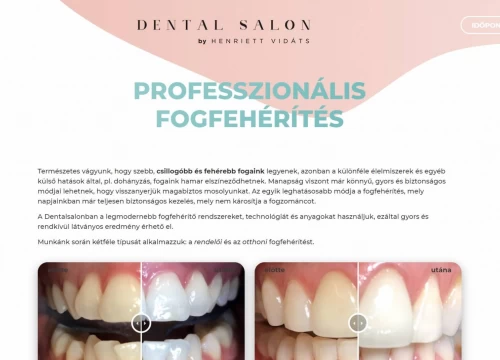 Fogászati honlap - Dental Salon